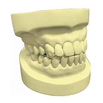 Gips EVO ROCK 5kg klasa IV OBG