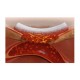 MEDISPONGE SPECIAL 70x50x1mm /gąbka żelatynowa sterylna/ EUCARE PHARMACEUTICALS