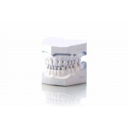 Gips KFO STONE ortodontyczny 300 IV klasa 5 kg ekstra biały OBG