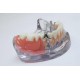 Polimer VILLACRYL STC HOT do lic. koron i mostów 80g + 40ml EVERALL7