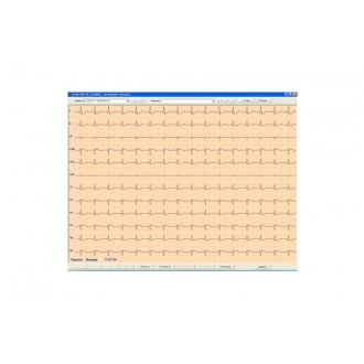 CARDIOTEKA v.211SOFT Oprogramowanie ASPEL ECG